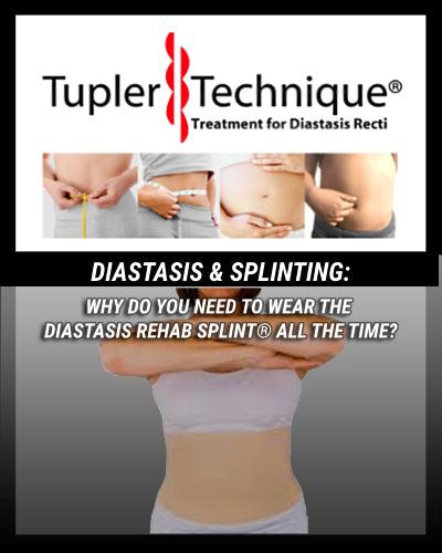 DO YOU NEED TO WEAR THE DIASTASIS REHAB SPLINT® ALL THE TIME? - diastasisrehab