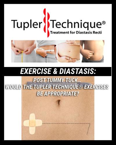 Enhancing Your Tummy Tuck Results with Tupler Technique® Exercises: What You Need to Know - diastasisrehab