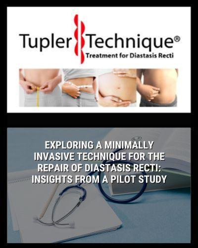 Exploring a Minimally Invasive Technique for the Repair of Diastasis Recti: Insights from a Pilot Study - diastasisrehab