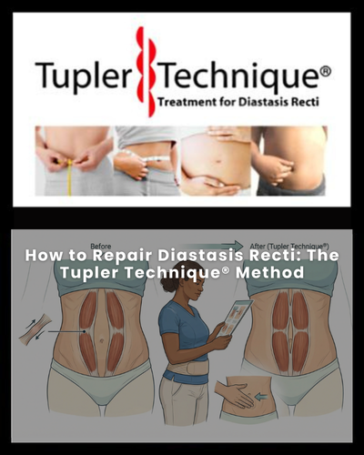 How to Repair Diastasis Recti: The Tupler Technique® Method