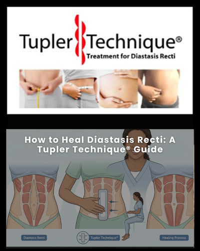 How to Heal Diastasis Recti: A Tupler Technique® Guide – diastasisrehab