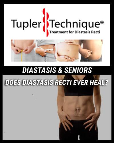 Healing Your Diastasis Recti: What You Need to Know - diastasisrehab