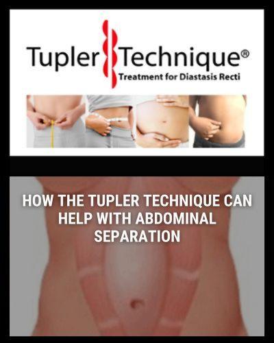 How the Tupler Technique® Can Help with Abdominal Separation