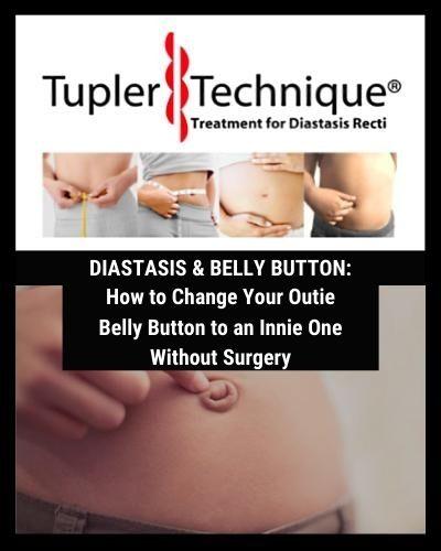 How to Change Your Outie Belly Button to an Innie One Without Surgery - diastasisrehab