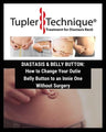 How to Change Your Outie Belly Button to an Innie One Without Surgery