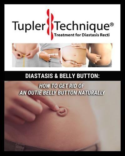 HOW TO GET RID OF AN OUTIE BELLY BUTTON NATURALLY - diastasisrehab