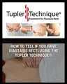 How to Tell if You Have Diastasis Recti Using the Tupler Technique®