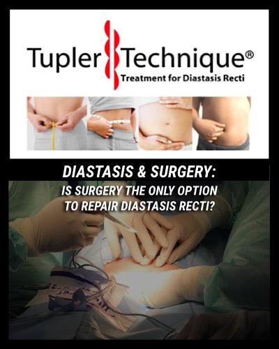 Is Diastasis Recti Surgery Your Only Option? Find Out Now! - diastasisrehab