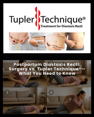 Postpartum Diastasis Recti: Surgery vs. Tupler Technique®—What You Need to Know