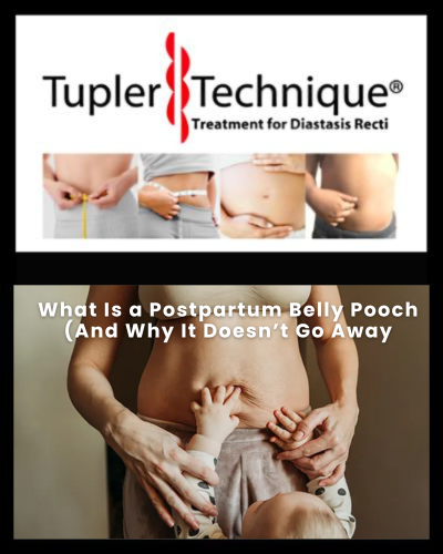 What Is a Postpartum Belly Pooch (And Why It Doesn’t Go Away
