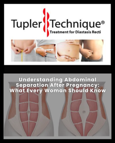 Understanding Abdominal Separation After Pregnancy - Diastasis Rehab