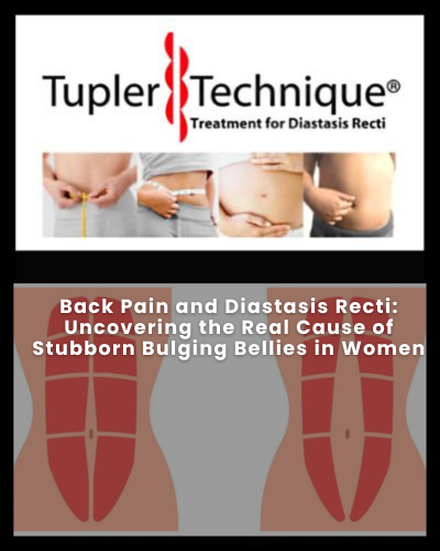 Uncovering the Real Cause of Stubborn Bulging Bellies in Women - Diastasis Rehab