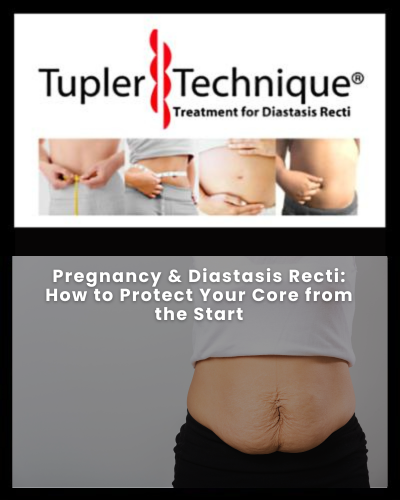 Pregnancy & Diastasis Recti: How to Protect Your Core from the Start