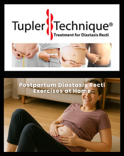 Postpartum Diastasis Recti Exercises at Home - Diastasis Rehab