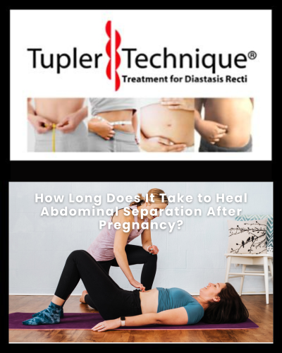 How Long Does It Take to Heal Abdominal Separation After Pregnancy?