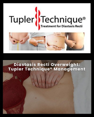 Diastasis Recti Overweight: Tupler Technique® Management