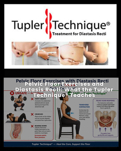 Pelvic Floor Exercises and Diastasis Recti: What the Tupler Technique® Teaches