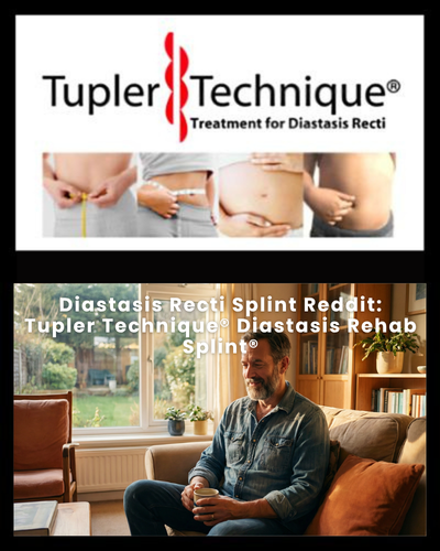 Diastasis Recti Splint Reddit: Tupler Technique® Diastasis Rehab Splint®
