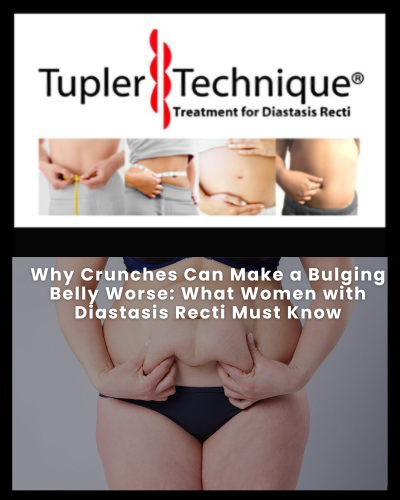 Why Crunches Can Make a Bulging Belly Worse - Diastasis Rehab