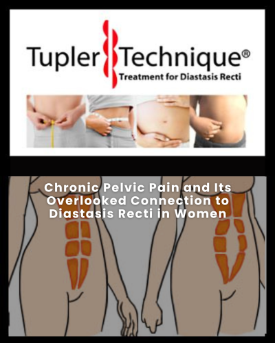 Women Pelvic Pain Overlooked Connection to Diastasis Recti - Diastasis Rehab