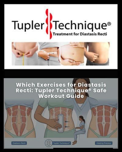 Which Exercises for Diastasis Recti: Tupler Technique® Safe Workout Guide