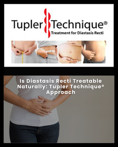 Is Diastasis Recti Treatable Naturally: Tupler Technique® Approach