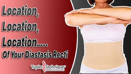 Location, Location, Location….. Of Your Diastasis Recti - diastasisrehab