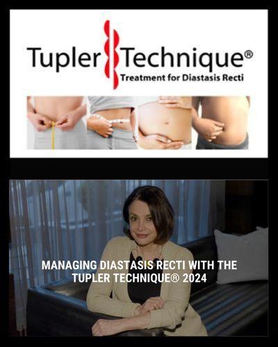 Managing Diastasis Recti with the Tupler Technique® 2024 - diastasisrehab