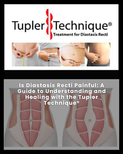 Is Diastasis Recti Painful: A Guide to Understanding and Healing with the Tupler Technique®