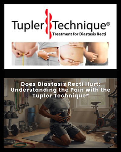 Diastasis Recti Back Pain: Tupler Technique® for a Stronger Back