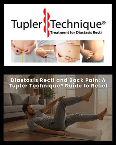 Diastasis Recti and Back Pain: A Tupler Technique® Guide to Relief