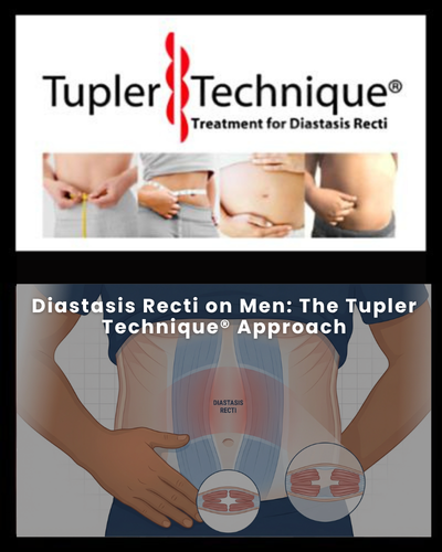 Diastasis Recti on Men: The Tupler Technique® Approach