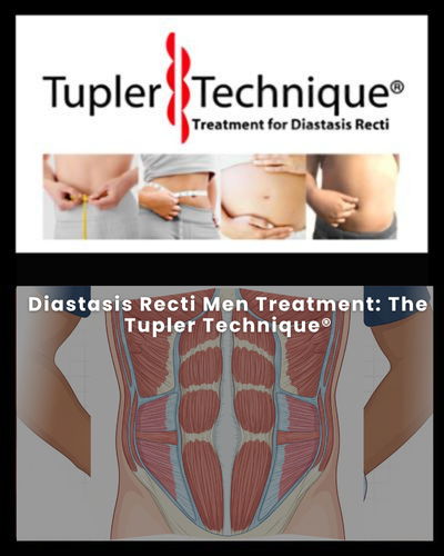 Diastasis Recti Men Treatment: The Tupler Technique®