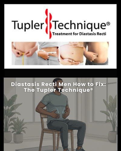 Diastasis Recti Men How to Fix: The Tupler Technique®