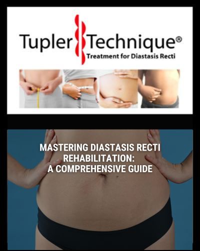 Mastering Diastasis Recti Rehabilitation: A Comprehensive Guide - diastasisrehab