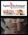Signs of Diastasis Recti After Delivery Tupler Technique® Checklist