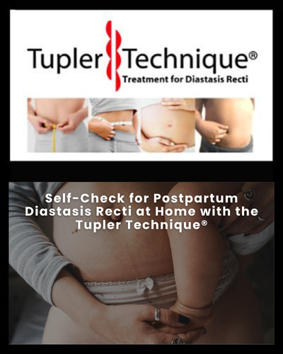 Self-Check for Postpartum Diastasis Recti at Home - Diastasis Rehab