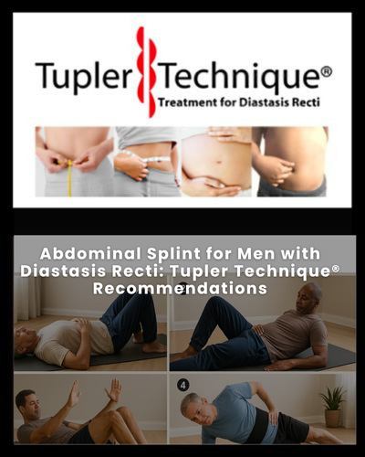 Abdominal Splint for Men with Diastasis Recti: Tupler Technique® Recommendations
