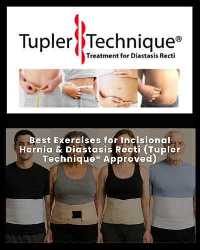Best Exercises for Incisional Hernia & Diastasis Recti (Tupler Technique® Approved)