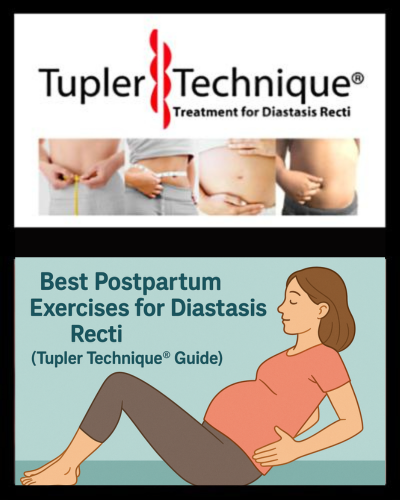 Best Postpartum Exercises for Diastasis Recti - Tupler Technique