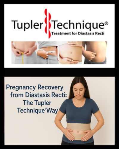 Pregnancy Recovery from Diastasis Recti: The Tupler Technique® Way