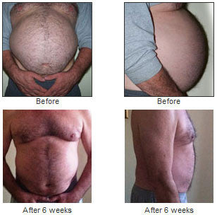 DO you have a bulging Belly? DOWNLOAD DIASTSIS RECTI EXERCISE TIPS - Diastasis Rehab