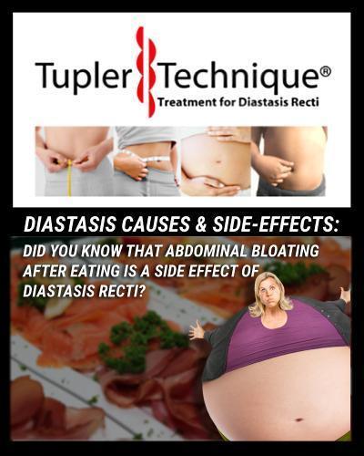 Say Goodbye to Bloating After Eating with the Tupler Technique® - The Ultimate Non-Surgical Solution for Diastasis Recti - diastasisrehab