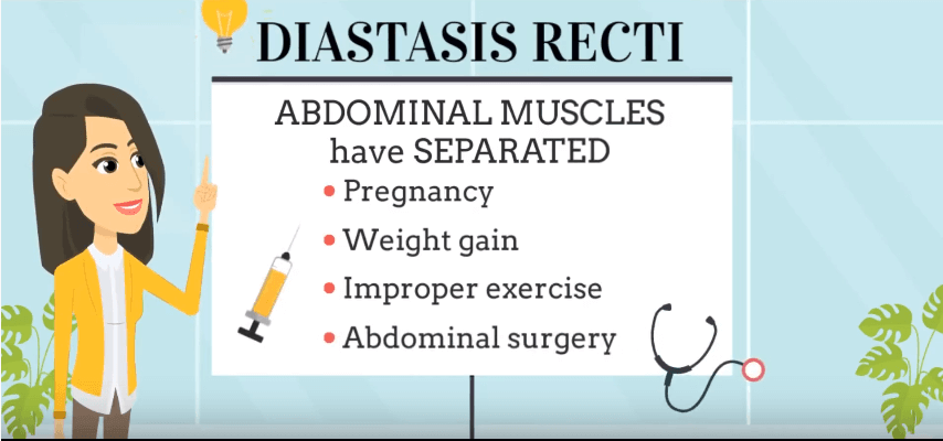 Say Goodbye to Your Bulging Belly with the Tupler Technique® for Diastasis Recti