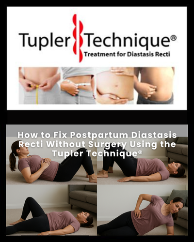 How to Fix Postpartum Diastasis Recti Without Surgery Using the Tupler Technique®