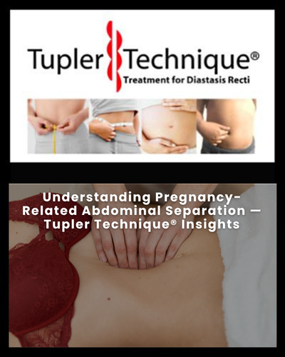 Understanding Pregnancy-Related Abdominal Separation — Tupler Technique® Insights