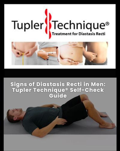 Signs of Diastasis Recti in Men - Diastasis Rehab