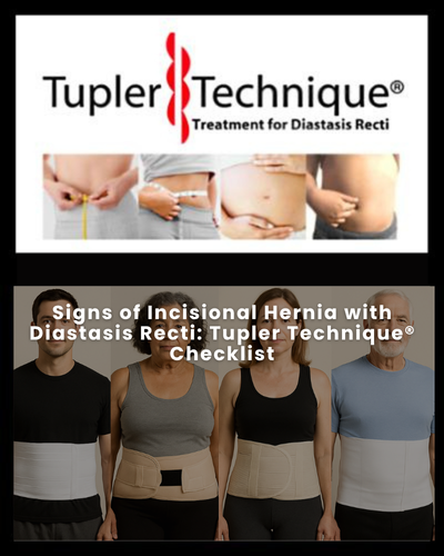Signs of Incisional Hernia with Diastasis Recti - Diastasis Rehab