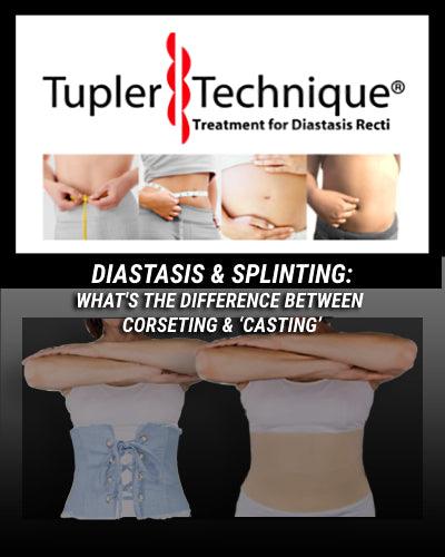Splinting vs. Corseting: What's the Best Way to Close Your Diastasis? - diastasisrehab