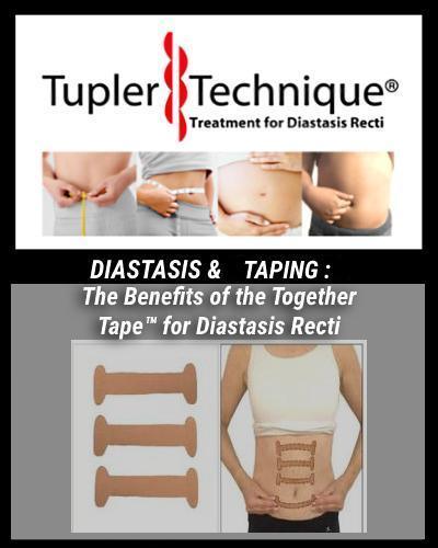 The Benefits of the Together Tape™ for Diastasis Recti - diastasisrehab